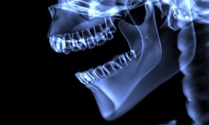 Cas clinique : Traitements endodontiques